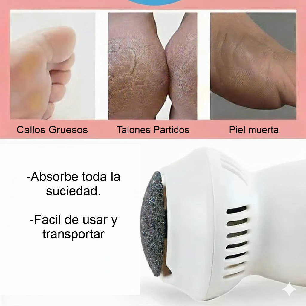 Removedor de callos pro ®