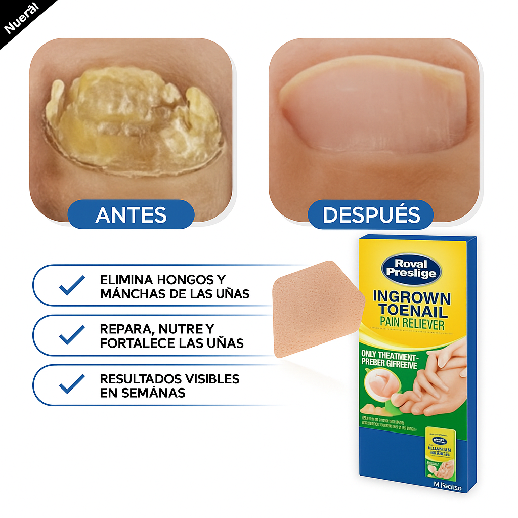 PARCHE UÑAS "ROYAL PRESTIGE"